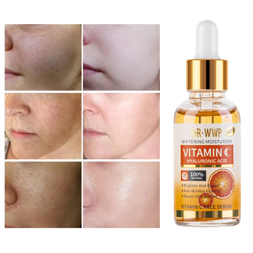 Skincare Garnier - Disaar witamina C 30ml Serum do