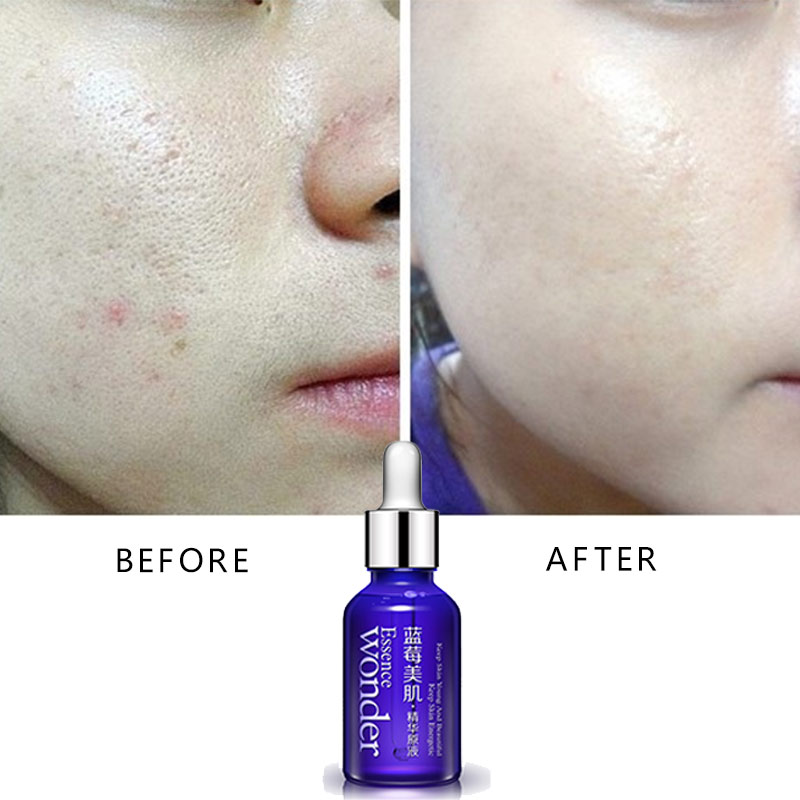 BIOAQUA Blueberry Face Lifting – Skincare Garnier recenzja i cena
