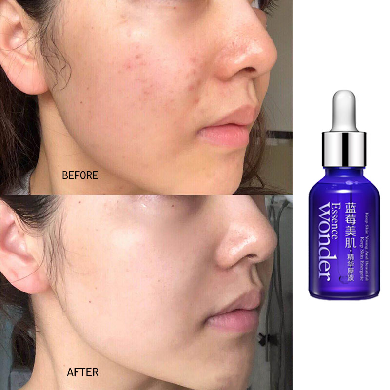 BIOAQUA Blueberry Face Lifting – Skincare Garnier recenzja i cena