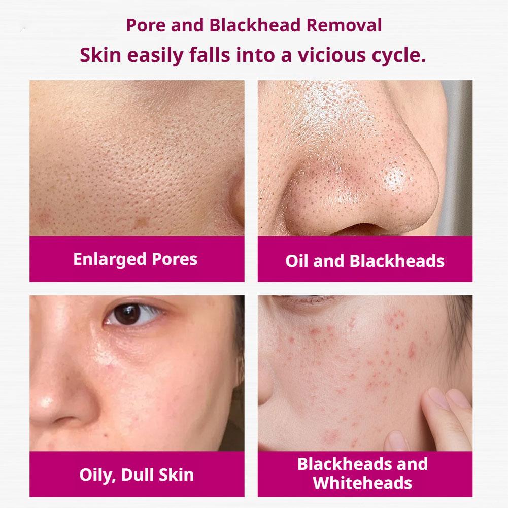 Serum z kwasem salicylowym zwę – Glycolic Acid Exfoliant recenzja i cena