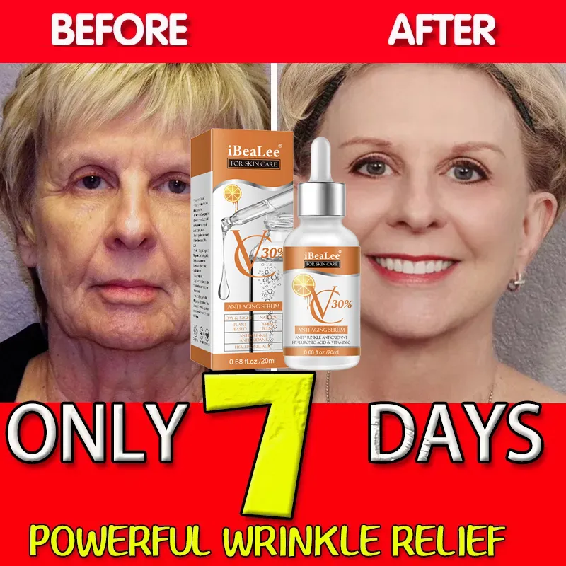 Premium 30% Serum witaminowo-C – Skincare Garnier recenzja i cena