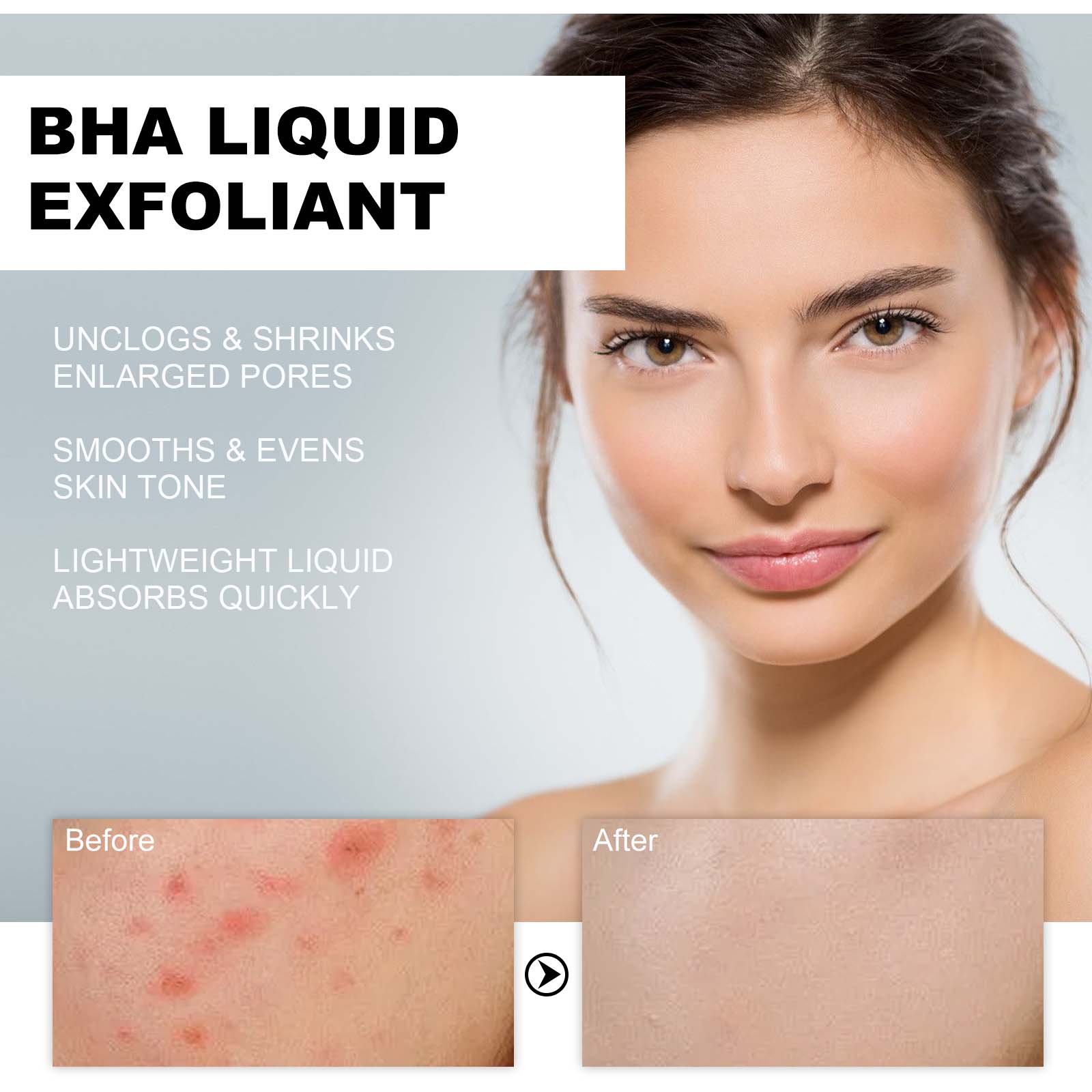 2% Kwas Salicylowy w Płynie -  – Glycolic Acid Exfoliant recenzja i cena