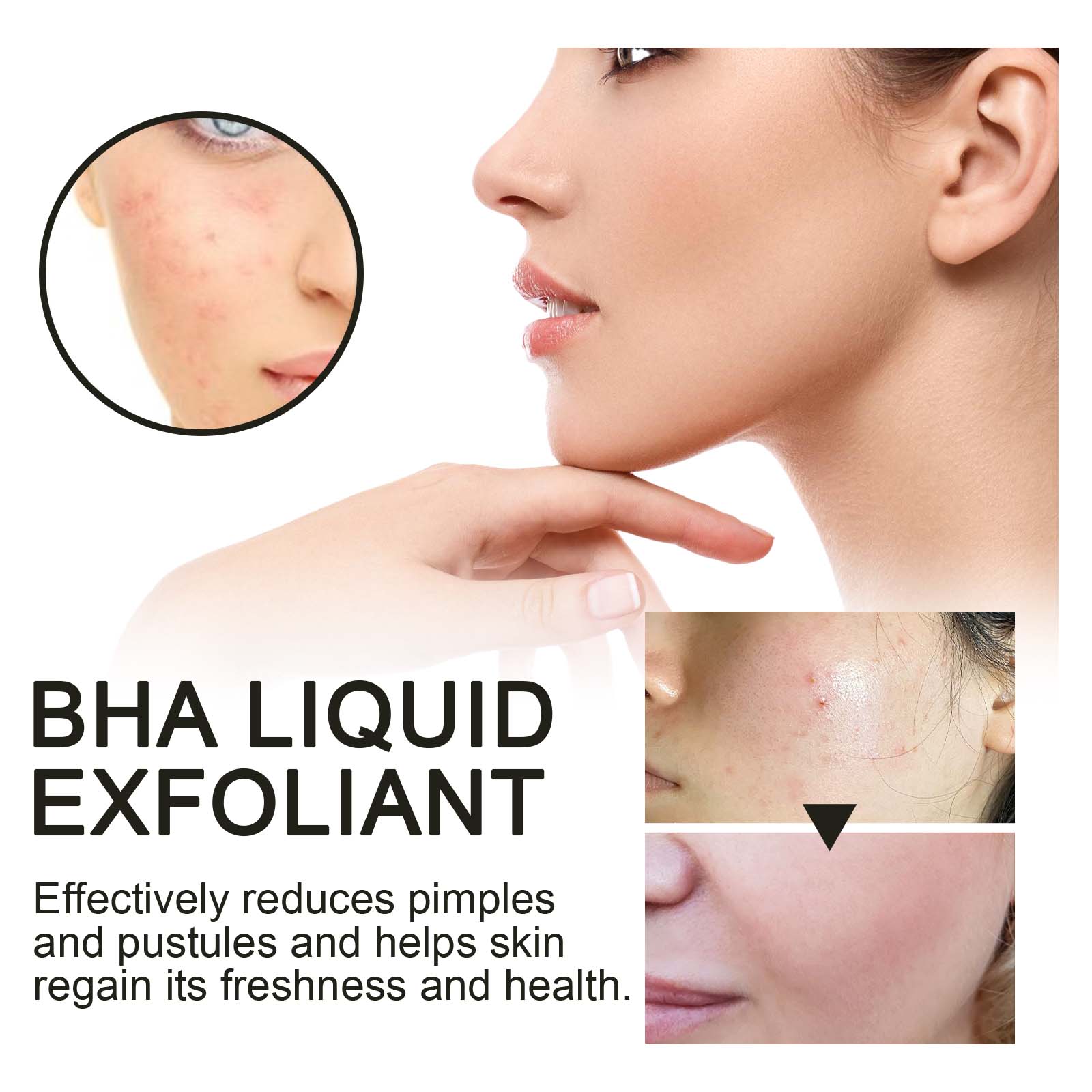 2% Kwas Salicylowy w Płynie -  – Glycolic Acid Exfoliant recenzja i cena